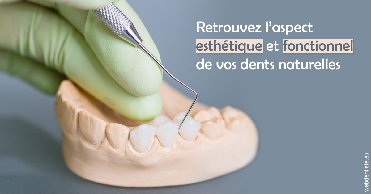 https://dr-loic-calvo.chirurgiens-dentistes.fr/Restaurations dentaires 1