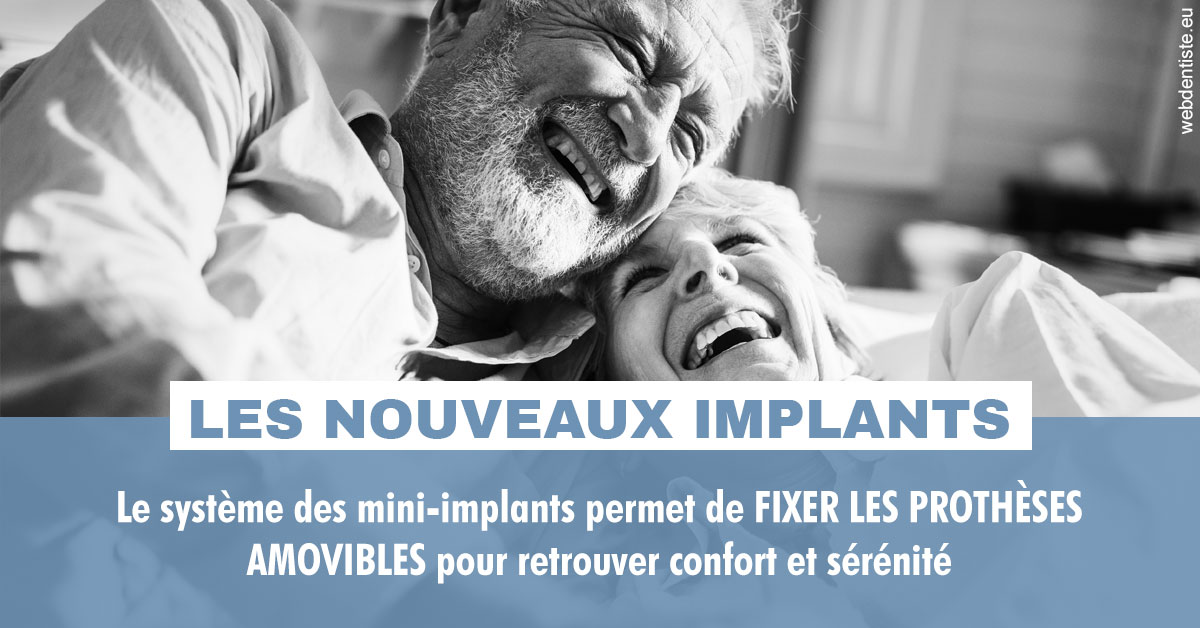 https://dr-loic-calvo.chirurgiens-dentistes.fr/Les nouveaux implants 2