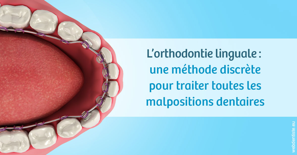 https://dr-loic-calvo.chirurgiens-dentistes.fr/L'orthodontie linguale 1