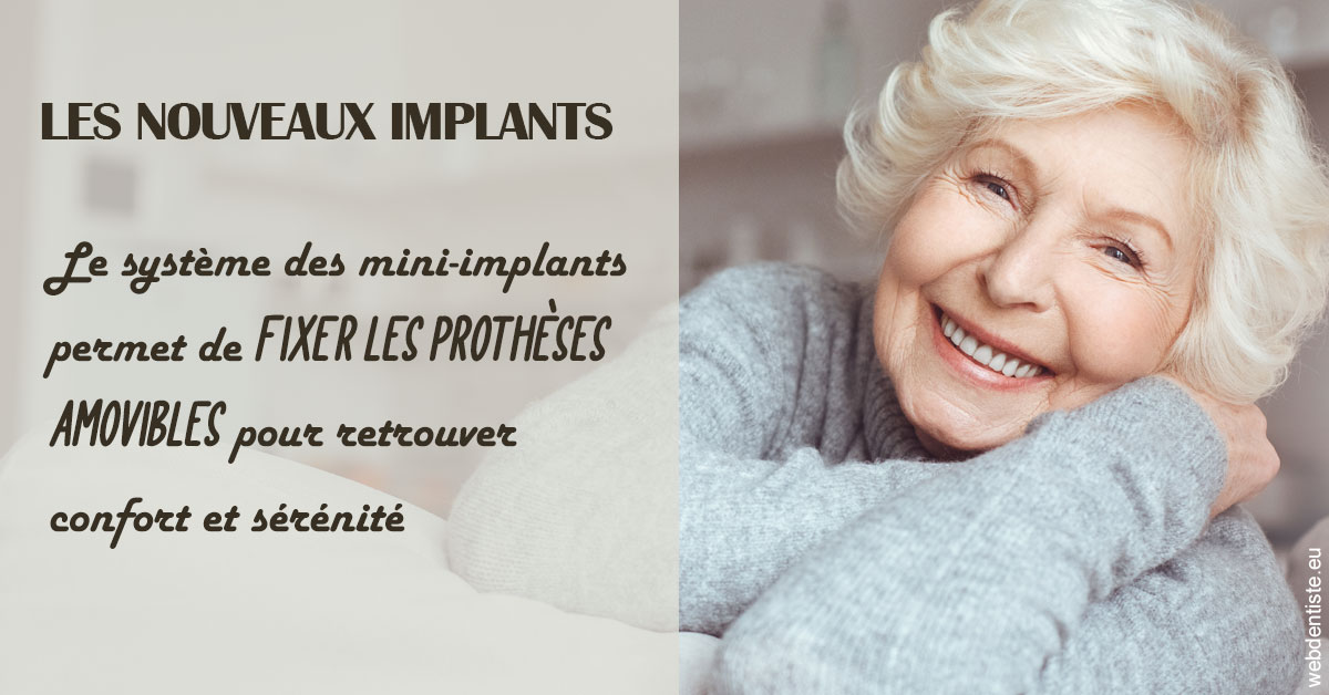 https://dr-loic-calvo.chirurgiens-dentistes.fr/Les nouveaux implants 1