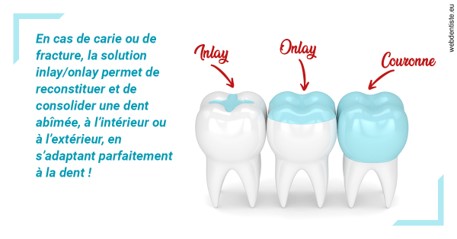 https://dr-loic-calvo.chirurgiens-dentistes.fr/L'INLAY ou l'ONLAY