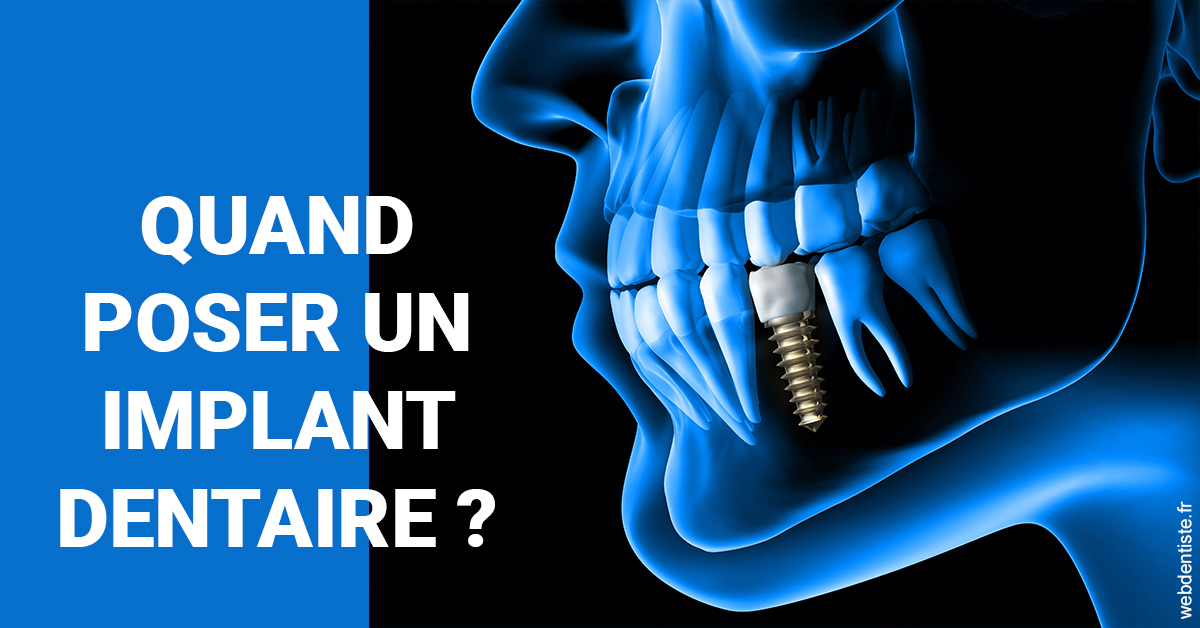 https://dr-loic-calvo.chirurgiens-dentistes.fr/Les implants 1