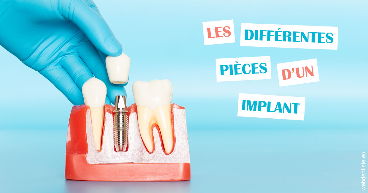 https://dr-loic-calvo.chirurgiens-dentistes.fr/Les différentes pièces d’un implant 2