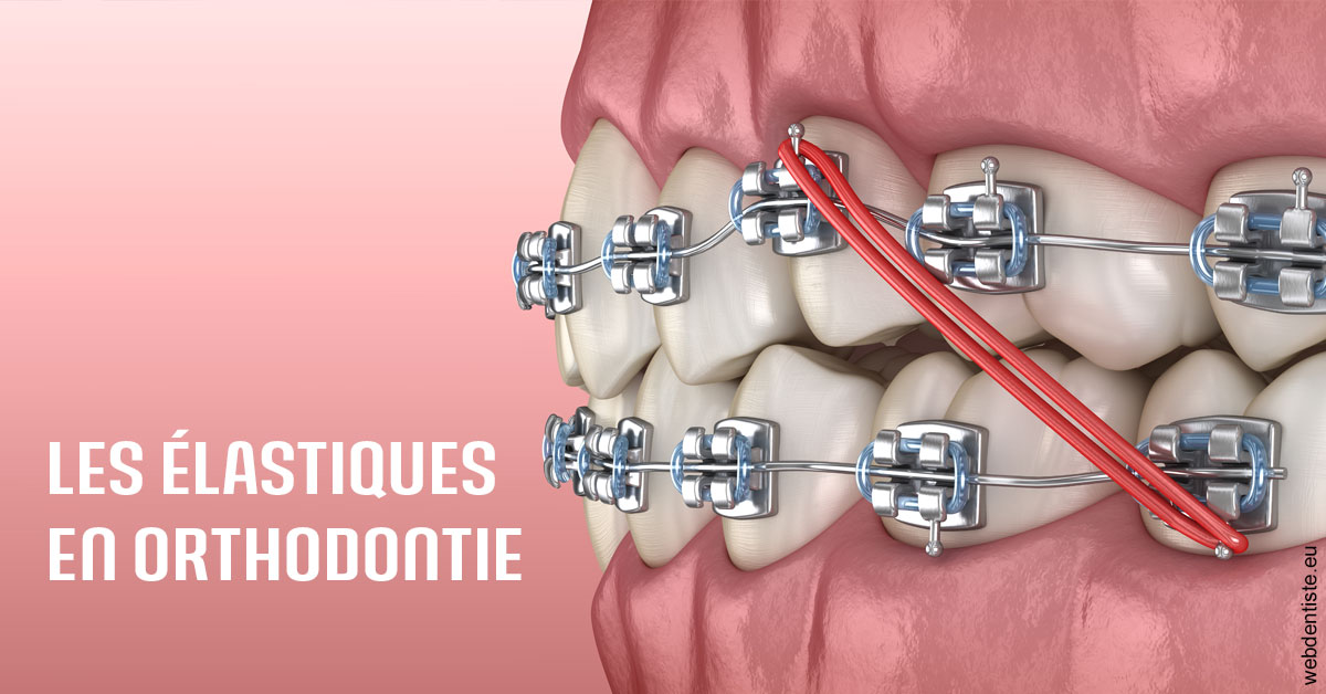 https://dr-loic-calvo.chirurgiens-dentistes.fr/Elastiques orthodontie 2